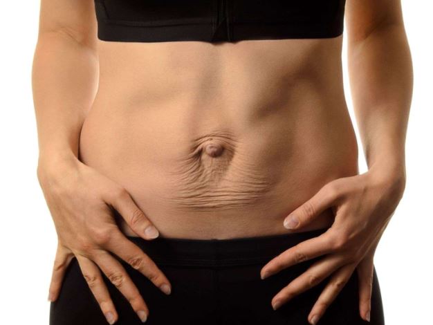 Lee más sobre el artículo Barriga postparto: ¿Cuánto tarda en irse y qué puedes hacer para ayudar a tu cuerpo?